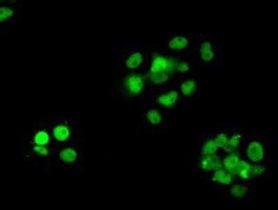 Immunocytochemistry/ Immunofluorescence: RPA2 Antibody (OTI9A1) [NBP2-02182]