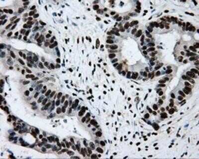 Immunohistochemistry-Paraffin: RPA2 Antibody (OTI9A1) [NBP2-02182]