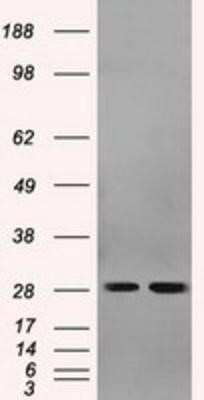 Western Blot: RPA2 Antibody (OTI9A1) [NBP2-02182]