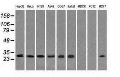 Western Blot: RPA2 Antibody (OTI9A1) [NBP2-02182]
