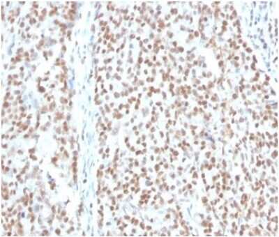 Immunohistochemistry-Paraffin: RPA2 Antibody (RPA2/4774) [NBP3-13764]