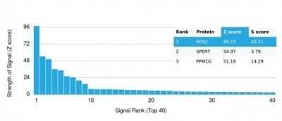 Protein Array: RPA2 Antibody (RPA2/4774) [NBP3-13764]