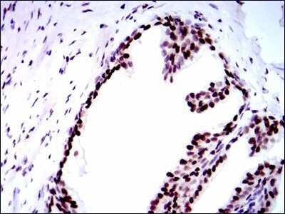 Immunohistochemistry: RPA70 Antibody (4C4) - BSA Free [NBP2-37500]