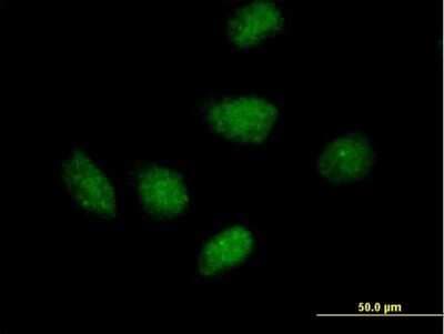Immunocytochemistry/ Immunofluorescence: RPAIN Antibody [H00084268-B01P]