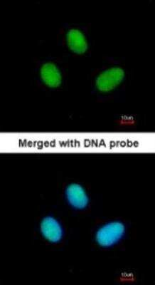 Immunocytochemistry/ Immunofluorescence: RPB2 Antibody [NBP2-53092]
