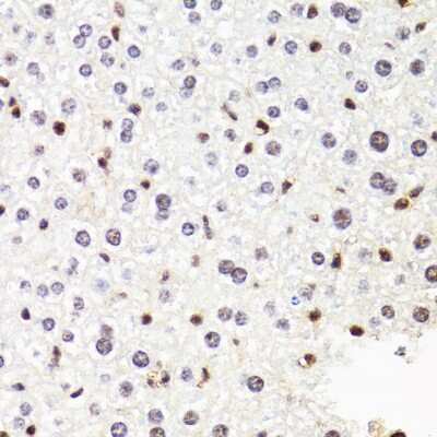 Immunohistochemistry-Paraffin: RPB2 Antibody - BSA Free [NBP2-93593]