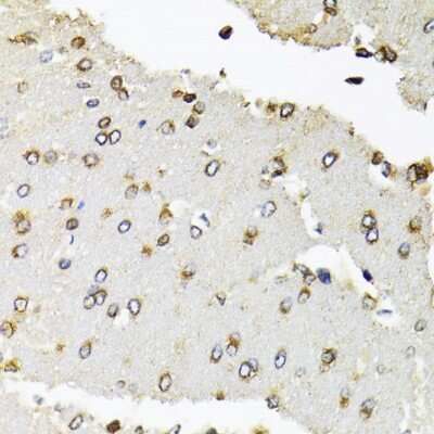 Immunohistochemistry-Paraffin: RPB2 Antibody - BSA Free [NBP2-93593]