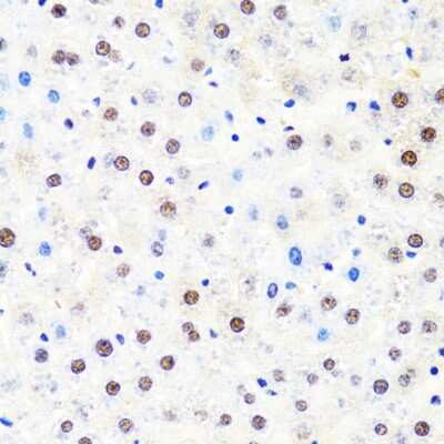 Immunohistochemistry-Paraffin: RPB2 Antibody - BSA Free [NBP2-93593]