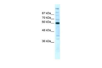 Western Blot: RPB2 Antibody [NBP2-88176]