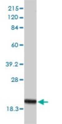 Western Blot: RPB8 Antibody (3G6-1A4) [H00005437-M01]