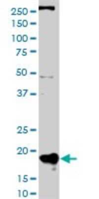 Western Blot: RPB8 Antibody (3G6-1A4) [H00005437-M01]
