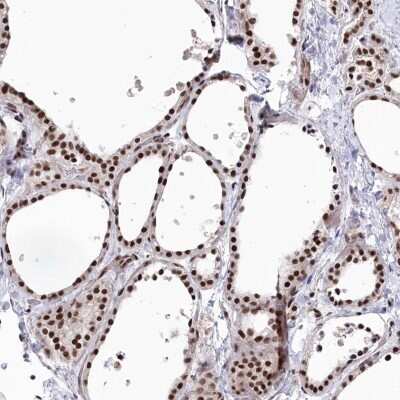 Immunohistochemistry-Paraffin: RPB8 Antibody [NBP1-80816]