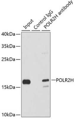 Immunohistochemistry-Paraffin: RPB8 Antibody - BSA Free [NBP2-93995]