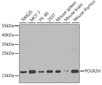 Western Blot: RPB8 AntibodyBSA Free [NBP2-95227]
