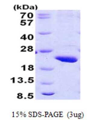 SDS-PAGE: Recombinant Human RPB8 His Protein [NBP2-23345]