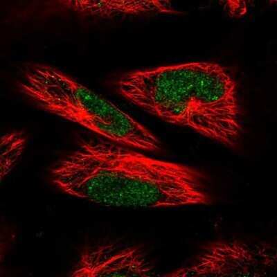 Immunocytochemistry/ Immunofluorescence: RPC62 Antibody [NBP1-87111]