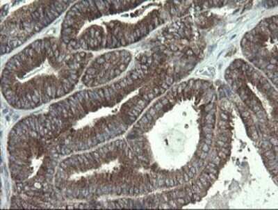Immunohistochemistry: RPC62 Antibody (OTI2H1) - Azide and BSA Free [NBP2-73942]