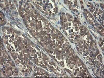 Immunohistochemistry: RPC62 Antibody (OTI2H1) - Azide and BSA Free [NBP2-73942]