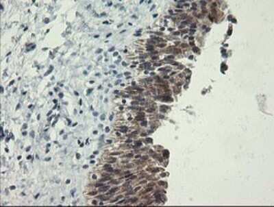 Immunohistochemistry: RPC62 Antibody (OTI2H1) - Azide and BSA Free [NBP2-73942]