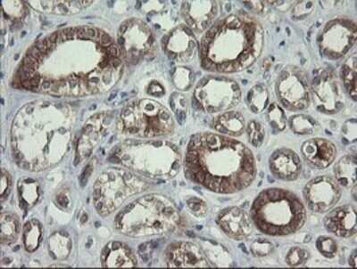 Immunohistochemistry: RPC62 Antibody (OTI2H1) - Azide and BSA Free [NBP2-73942]