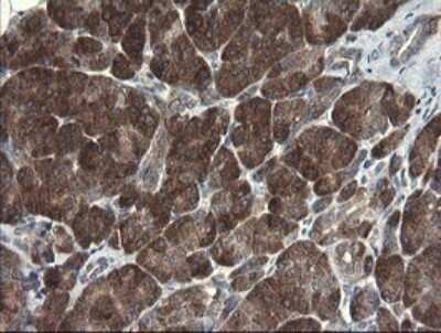 Immunohistochemistry: RPC62 Antibody (OTI2H1) - Azide and BSA Free [NBP2-73942]