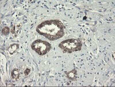 Immunohistochemistry: RPC62 Antibody (OTI2H1) [NBP2-45900]