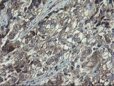 Immunohistochemistry: RPC62 Antibody (OTI2H1) [NBP2-45900]
