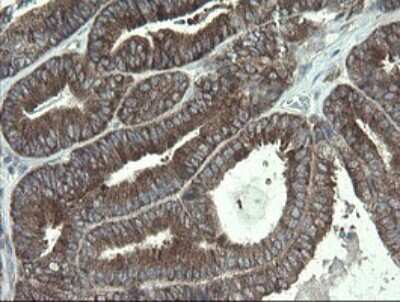 Immunohistochemistry: RPC62 Antibody (OTI2H1) [NBP2-45900]