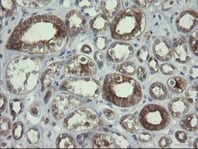 Immunohistochemistry: RPC62 Antibody (OTI2H1) [NBP2-45900]