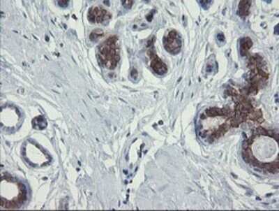 Immunohistochemistry: RPC62 Antibody (OTI2H1) [NBP2-45900]