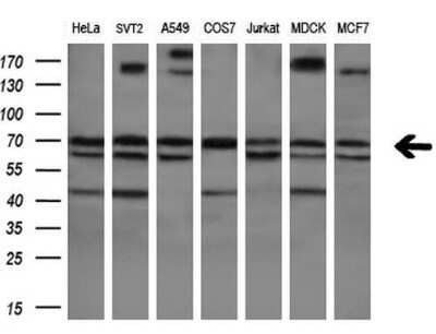 Western Blot: RPC62 Antibody (OTI2H1) [NBP2-45900]
