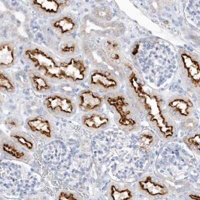 Immunohistochemistry: RPE Antibody [NBP2-32668]