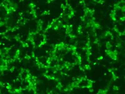 Immunocytochemistry/ Immunofluorescence: RPE65 Antibody (401.8B11.3D9) - Azide and BSA Free [NBP2-80931]