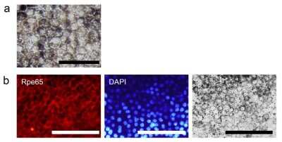Immunocytochemistry/ Immunofluorescence: RPE65 Antibody (401.8B11.3D9) - BSA Free [NB100-355]
