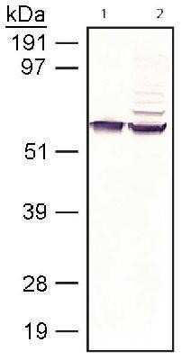 Western Blot: RPE65 Antibody (401.8B11.3D9)BSA Free [NB100-355]