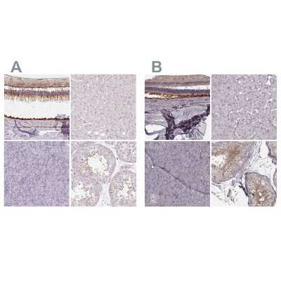 Immunohistochemistry-Paraffin: RPGRIP1 Antibody [NBP2-55753]
