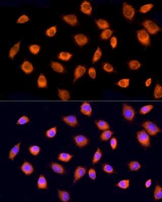 Immunocytochemistry/ Immunofluorescence: RPH3AL Antibody - BSA Free [NBP2-94887]