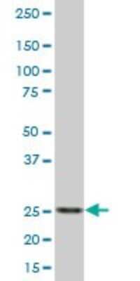 Western Blot: RPIA Antibody [H00022934-B01P]