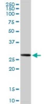 Western Blot: RPIA Antibody [H00022934-D01P]