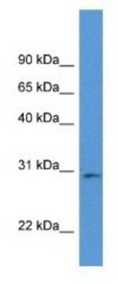 Western Blot: RPIA Antibody [NBP1-79588]