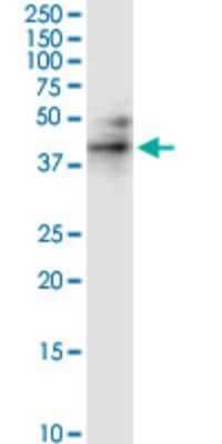 Western Blot: RPIP8 Antibody (1A8) [H00010900-M01]