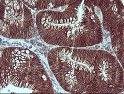 Immunohistochemistry: RPIP8 Antibody (OTI3C6) [NBP2-45638]