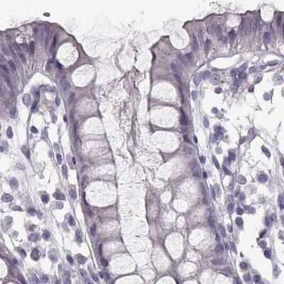 Immunohistochemistry-Paraffin: RPIP8 Antibody [NBP1-80855]