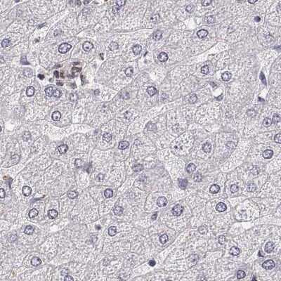 Immunohistochemistry-Paraffin: RPIP8 Antibody [NBP2-68906]