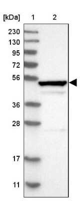 Western Blot: RPIP8 Antibody [NBP1-80855]