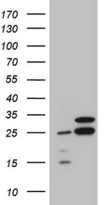 Western Blot: RPL10 Antibody (OTI6B11) [NBP2-45628]