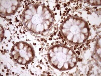 Immunohistochemistry: RPL10 Antibody (OTI6B11) - Azide and BSA Free [NBP2-73944]