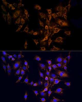 Immunocytochemistry/ Immunofluorescence: RPL10A Antibody - BSA Free [NBP2-93591]