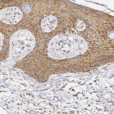 Immunohistochemistry-Paraffin: RPL10A Antibody [NBP2-47298]