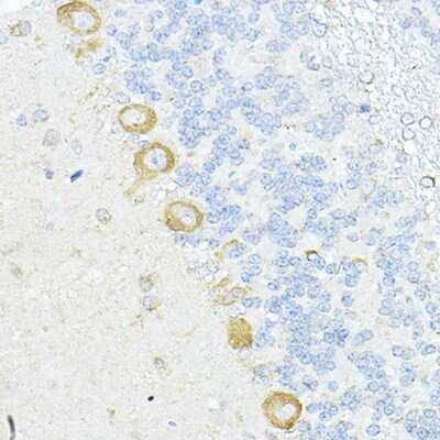 Immunohistochemistry-Paraffin: RPL10A Antibody - BSA Free [NBP2-93591]